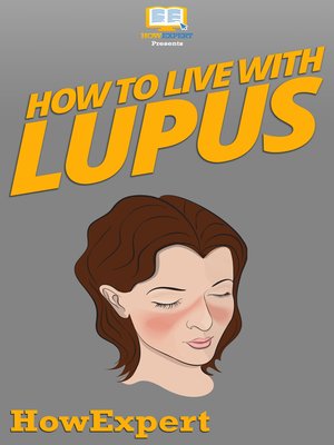 cover image of How to Live With Lupus
